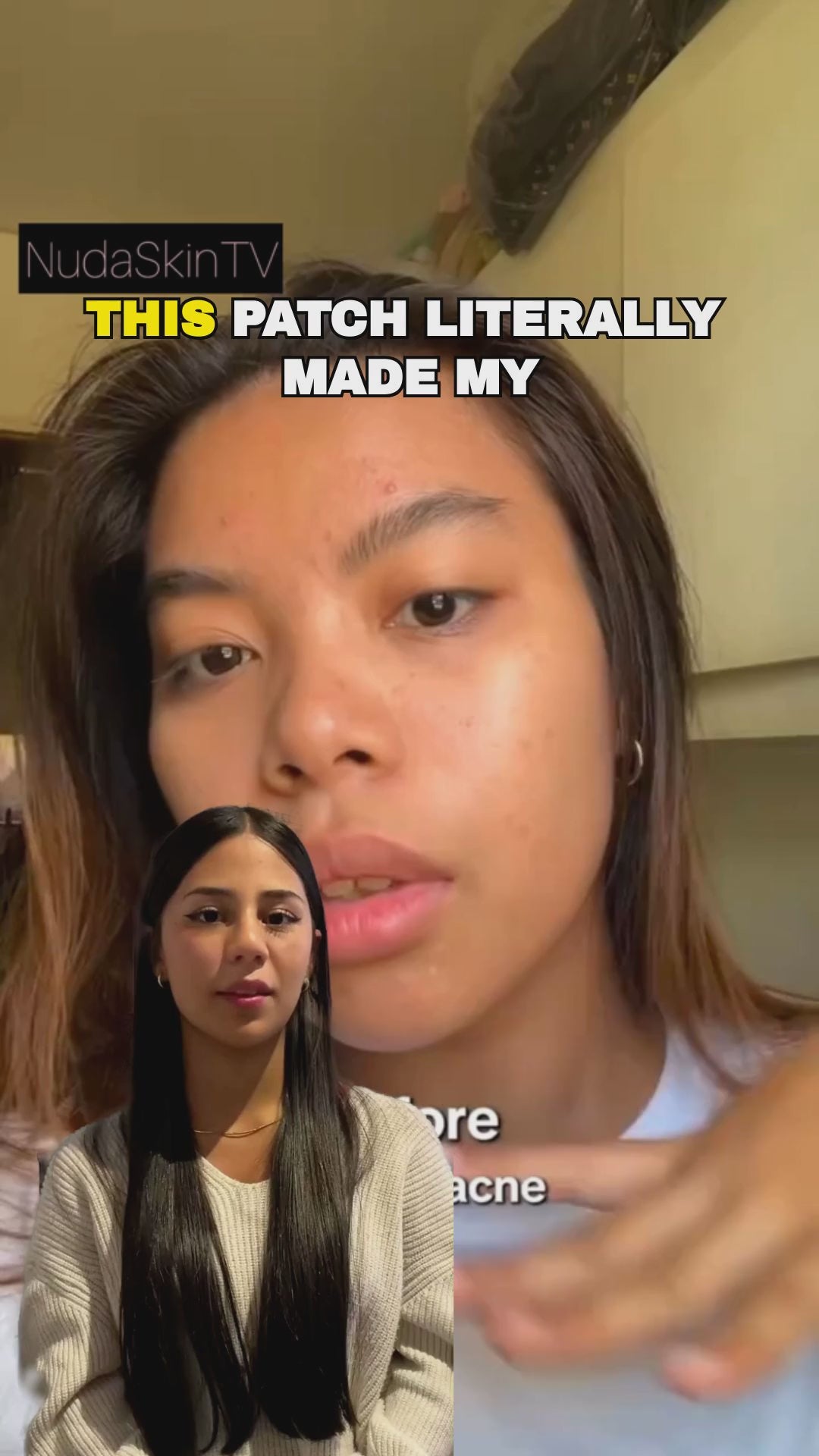 NudaSkin - Clear Patch™ Overnight Acne Relief video